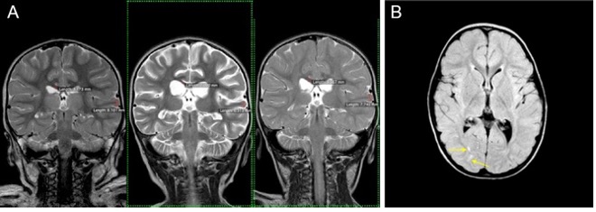 Brain X-Ray in Dallas Metro Area