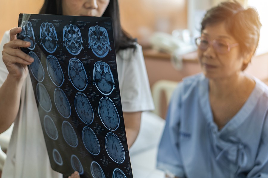 HBOT therapy for stroke recovery in the Dallas Metro Area