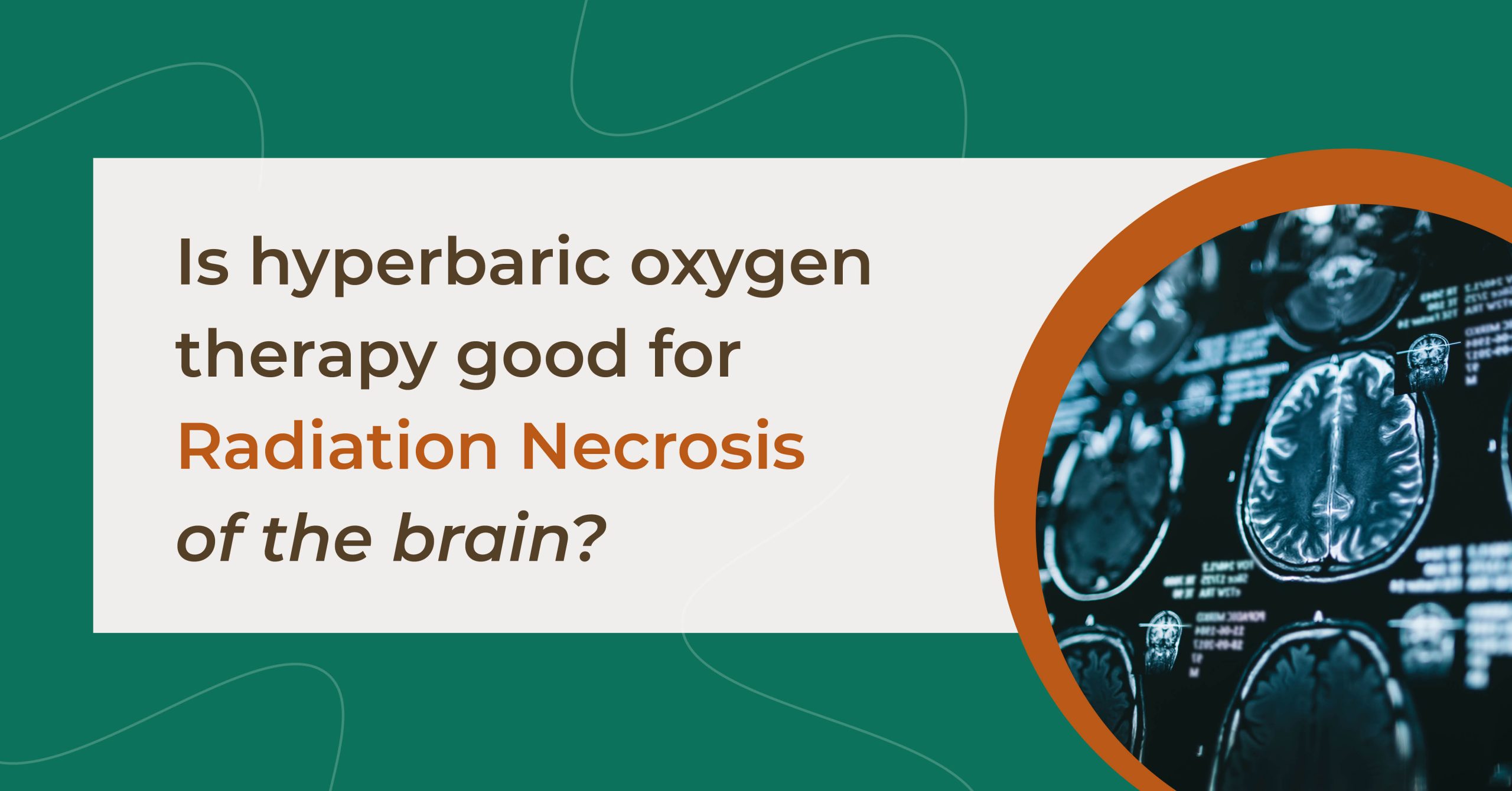 Is Hyperbaric Oxygen Therapy Good for Radiation Necrosis of the Brain?