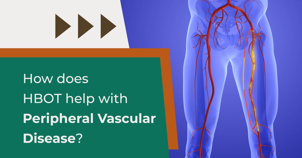 How Does Hyperbaric Oxygen Therapy Help with Peripheral Vascular Disease?