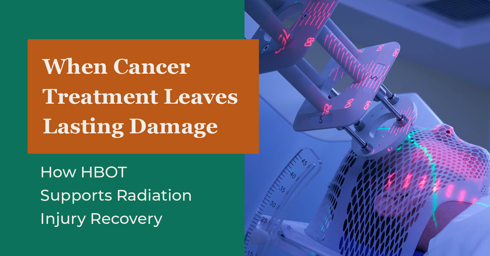 When Cancer Treatment Leaves Lasting Damage: How HBOT Supports Radiation Injury Recovery - woman receiving radiation treatment with mask over face